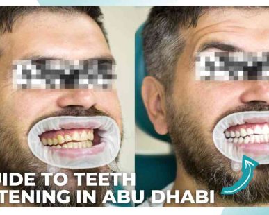 teeth Whitening in abu dhabi